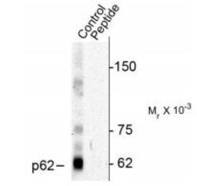 Western Blot: p62/SQSTM1 [p Thr269, p Ser272] Antibody [NBP2-29650]